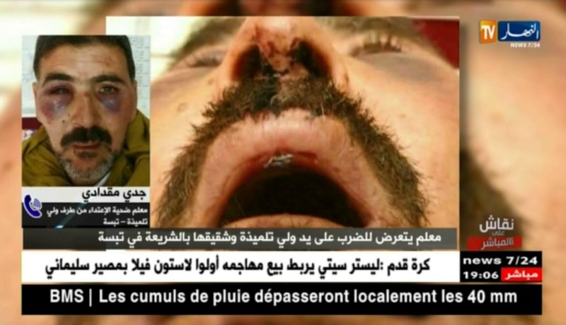 معلم ضحية إعتداء..هكذا إعتدى علي ولي تلميذة وإبنه بوحشية