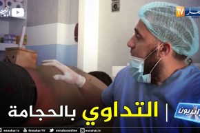 جزائريون: الحجامة طريقة طبية وقديمة للعلاج