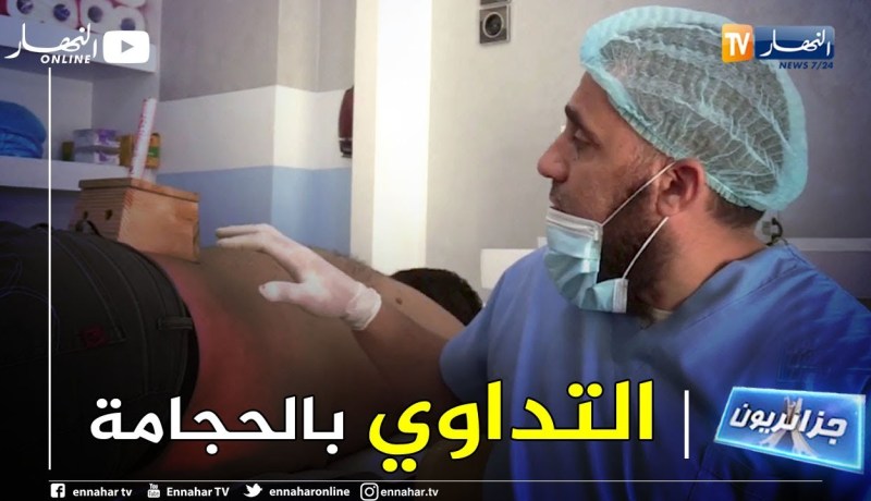 جزائريون: الحجامة طريقة طبية وقديمة للعلاج
