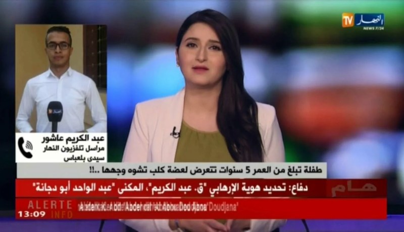 مراسل تلفزيون النهاربسيدي بلعباس:  سيتم نقل الطفلة إلى مستشفي عين تموشنت أو وهران لإستكمال العلاج