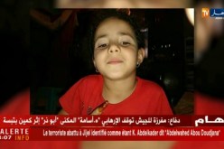سيدي بلعباس : كلب يهاجم طفلة تبلغ من العمر 6 سنوات