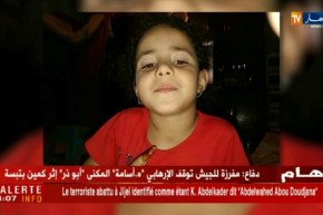 سيدي بلعباس : كلب يهاجم طفلة تبلغ من العمر 6 سنوات