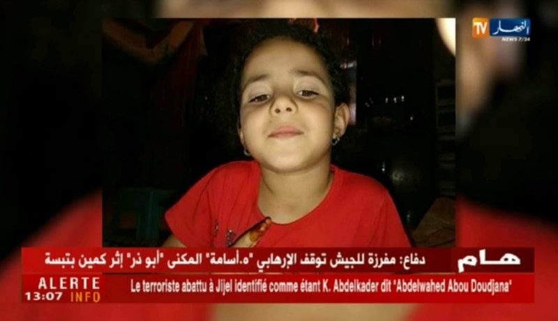 سيدي بلعباس : كلب يهاجم طفلة تبلغ من العمر 6 سنوات