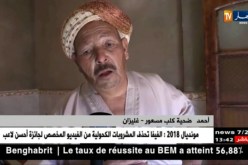 غليزان : إصابة خمسة أشخاص بعضات كلب مسعور ببلدية سيدي محمد بن عودة !!