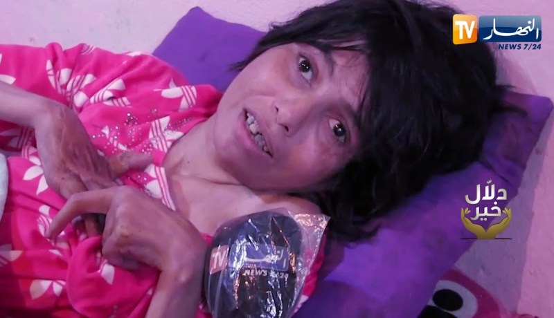 دلال خير: عجوز وإبنتها المصابة بمرض نادر يعيشان داخل كوخ يتوسط الأحراش والأودية