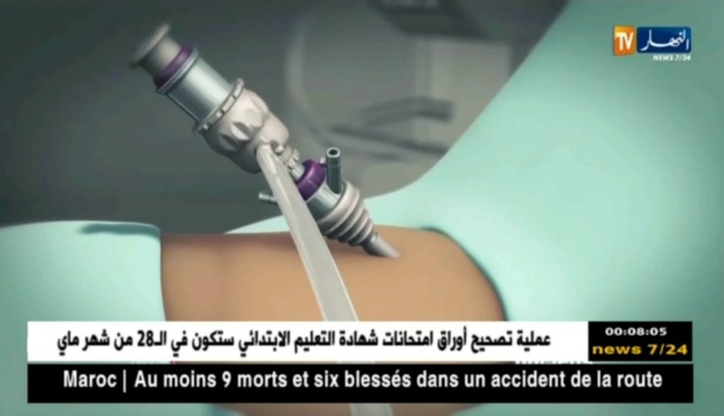 صحة: الكشف المبكر عن سرطان البروستات.. خطوة فعالة نحو النجاة !