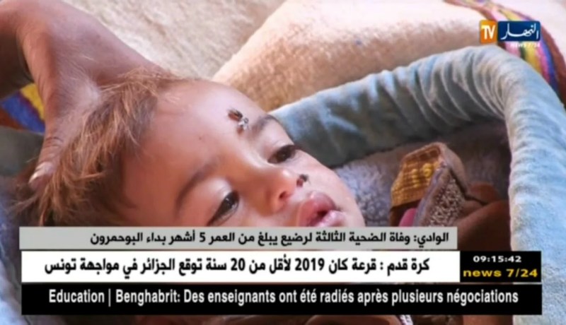 الوادي : وفاة الضحية الثالثة لرضيع يبلغ من العمر 5 أشهر بداء البوحمرون