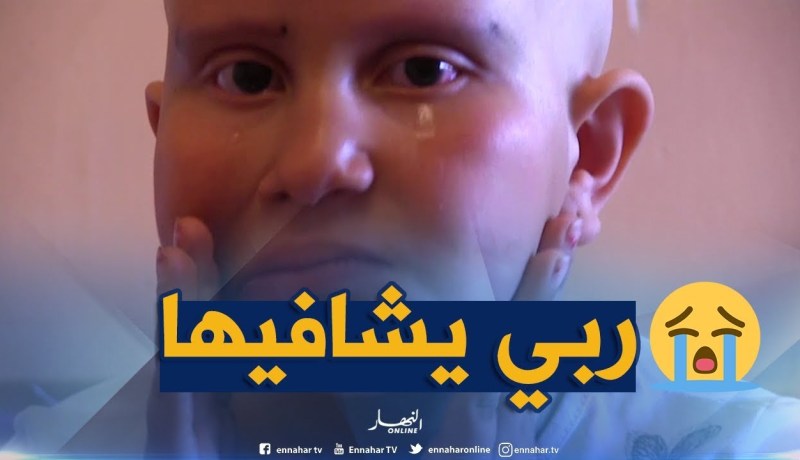 أم البواقي: داء الثعلبة يفقد الطفلة أشواق شعر رأسها وحاجبيها ورموش عينيها