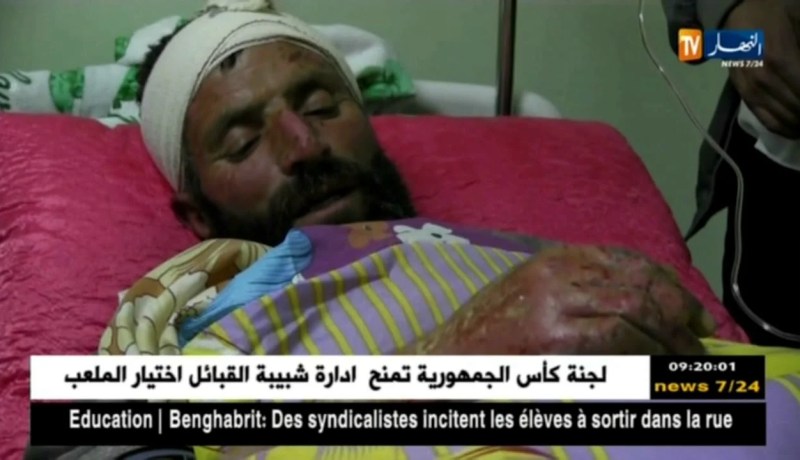 تبسة/ وفاة السجين المتسبب في قتل 5 أشخاص و إصابة 40 آخر بحروق