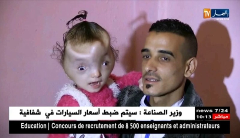 قسنطينة: عائلة بوشلاغم تناشد السلطات لمساعدتها في علاج إبنتها