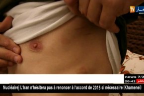 قالمة: أنت مريض.. تشخيص خاطئ يحول حياة شاب إلى جحيم