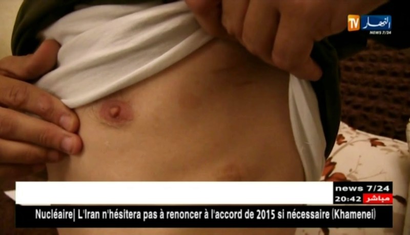 قالمة: أنت مريض.. تشخيص خاطئ يحول حياة شاب إلى جحيم