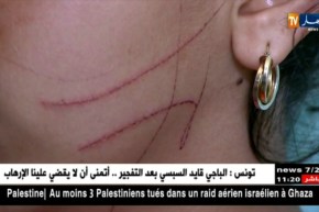 طب شرعي/ أزيد من 18 ألف عملية تشريح سنويا..والإعتداء الجنسي يتصدر القائمة