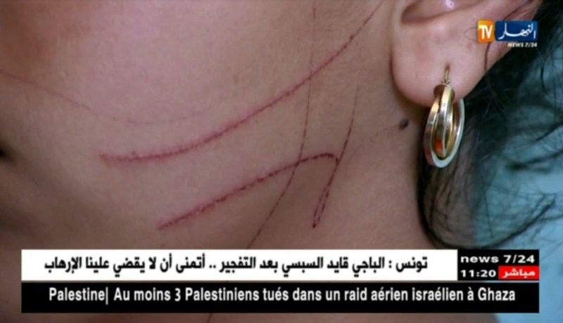 طب شرعي/ أزيد من 18 ألف عملية تشريح سنويا..والإعتداء الجنسي يتصدر القائمة