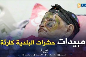 الأغواط: إصابة إمرأة وطفل بتشوهات وحروق بسبب رش البلدية لمبيدات الحشرات