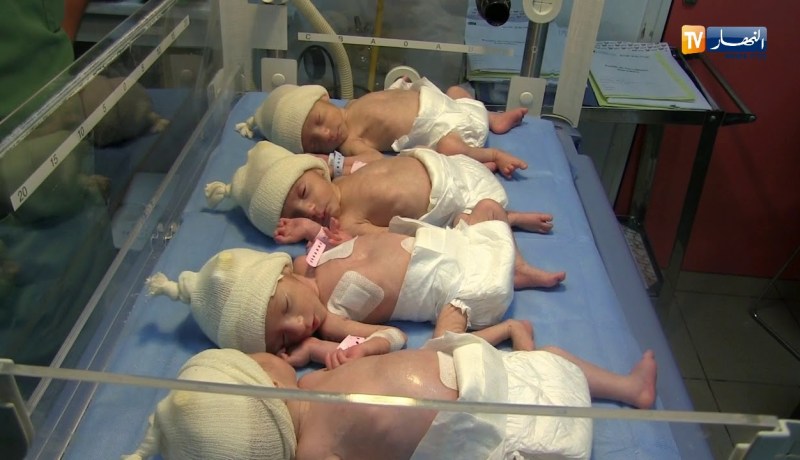العاصمة: نجاح طاقم طبي جزائري في عملية توليد لأربعة توائم ولدو قبل وقتهم