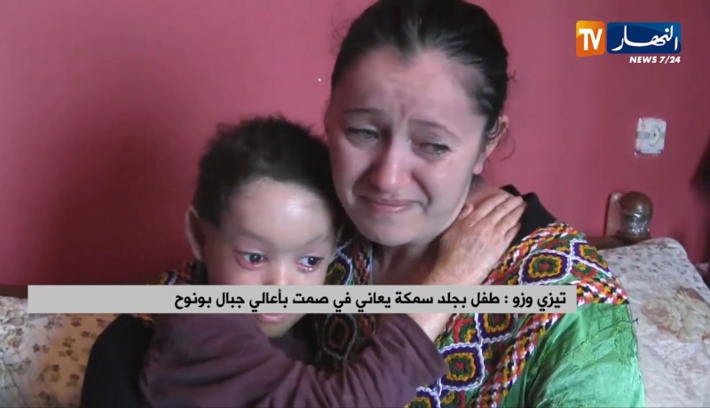 تيزي وزو: طفل بجلد سمكة يعاني في صمت بأعالي جبال بونوح