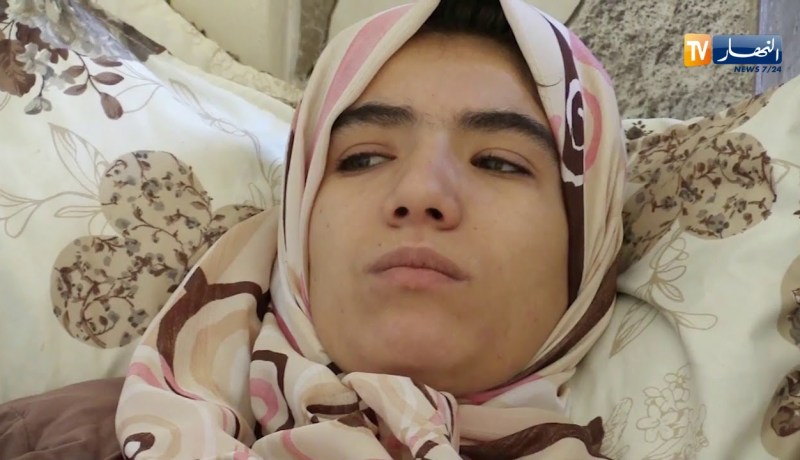 الظروف المعيشية القاسية تحرم “مريم” من إجراء عملية جراحية