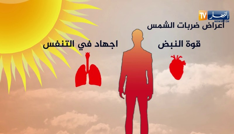أعراض ضربات الشمس