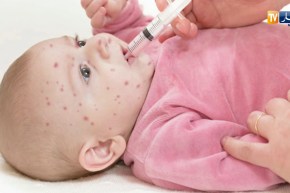 صحة: الوصاية تسجل أزيد من 300 إصابة بالحصبة الألمانية
