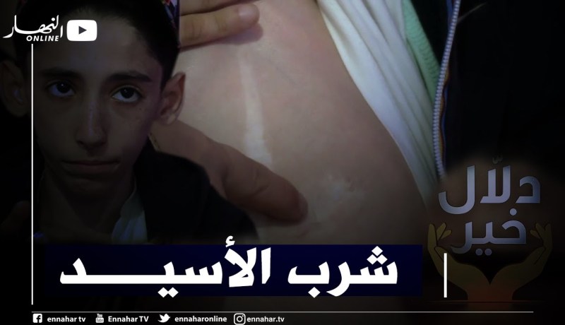 دلال خير: شاب يقاوم المرض بصعوبة بعد تجرعه لمادة كيميائية أتلفت جزء من رئته