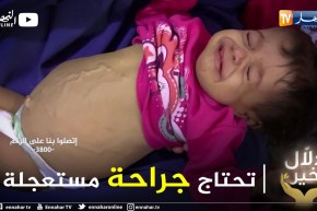 دلال خير: طفلة تعاني في صمت من داء التليف الكبدي.. تحتاج لعملية جراحية مستعجلة خارج الوطن