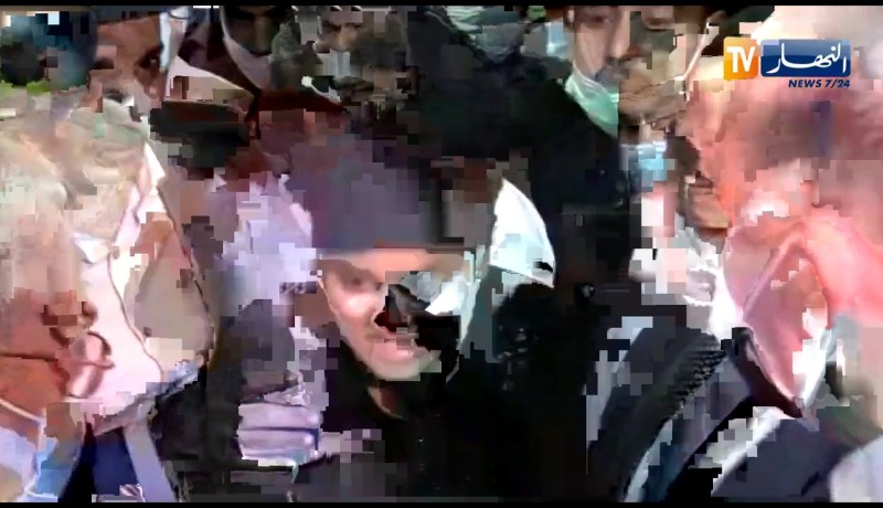 “شاهد إحدى ضحايا إنفجار أنبوب الغاز بالبيض تبكي بحرقة  “أختي تحرقت بين عينيا