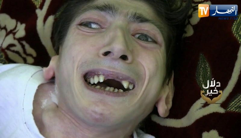 دلال خير: حمّى بسيطة جعلت من شاب طريح الفراش لـ 24 سنة ووالده لم يتحمل عبء علاجه