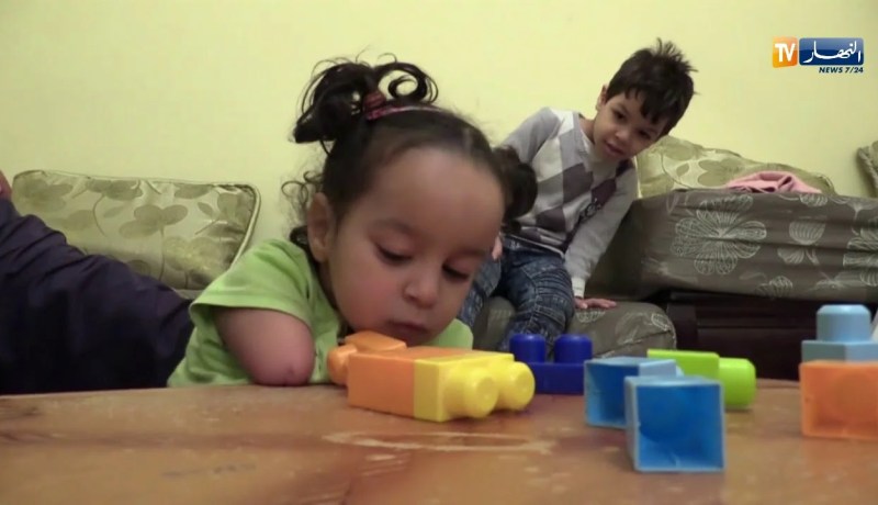 وهران/ البراءة “أسماء” تناشد المحسنين مساعدتها لتوفير أطراف إصطناعية لها