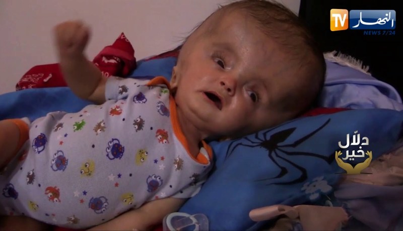 دلال خير: رضيع مهدد بالموت في أي لحظة بعدما عجز الوالد عن تأمين مصاريف العلاج