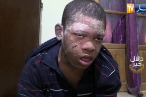 دلال خير: طفل من الوادي مصاب بمرض نادر أكل جسده وجلدة والأطباء لم يشخصوا حالته