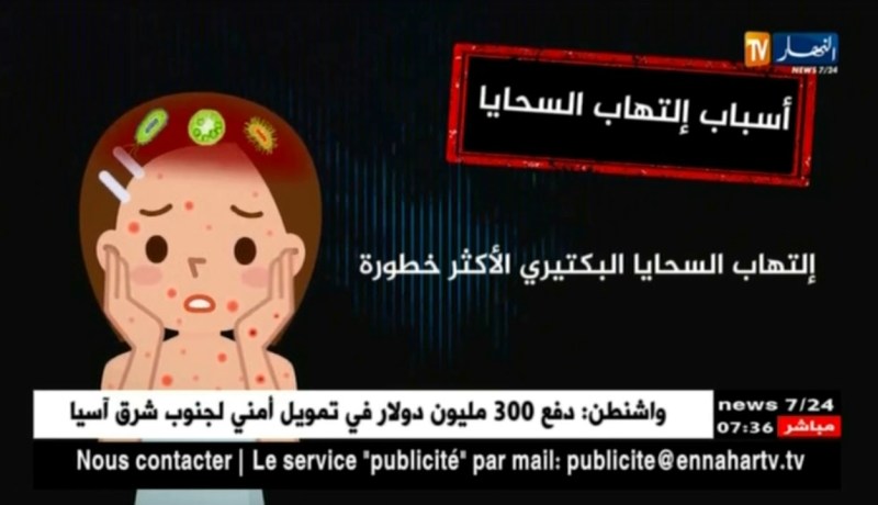 صحة: أسباب الإصابة بإلتهاب السحايا ..أعراضه و طرق الوقاية منه