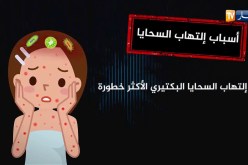 تعرف على مرض إلتهاب السحايا و طرق الوقاية منه !!