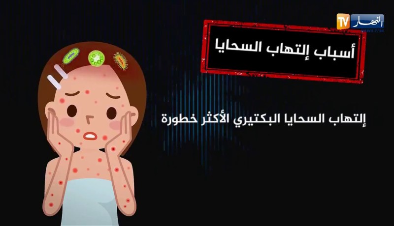 تعرف على مرض إلتهاب السحايا و طرق الوقاية منه !!