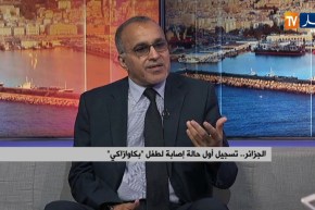 أوساط طبية..كاوازاكي مرض غامض يصيب الأطفال دون سن الخامسة