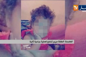 الطفلة مريم تخضع لعملية جراحية ثانية
