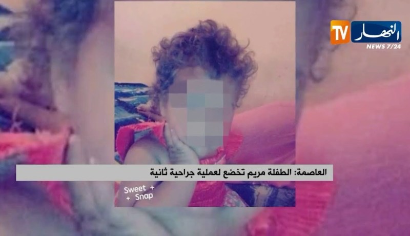 الطفلة مريم تخضع لعملية جراحية ثانية