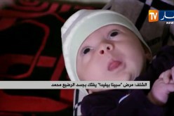 الشلف : مرض ” سبينا بيفيدا” يفتك بجسد الرضيع محمد
