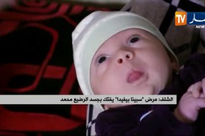 الشلف : مرض ” سبينا بيفيدا” يفتك بجسد الرضيع محمد