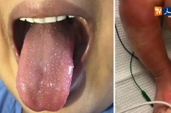 بعد تسجيل أول إصابة بالجزائر.. هذا هو مرض الكاوازاكي وهذه أغراضه