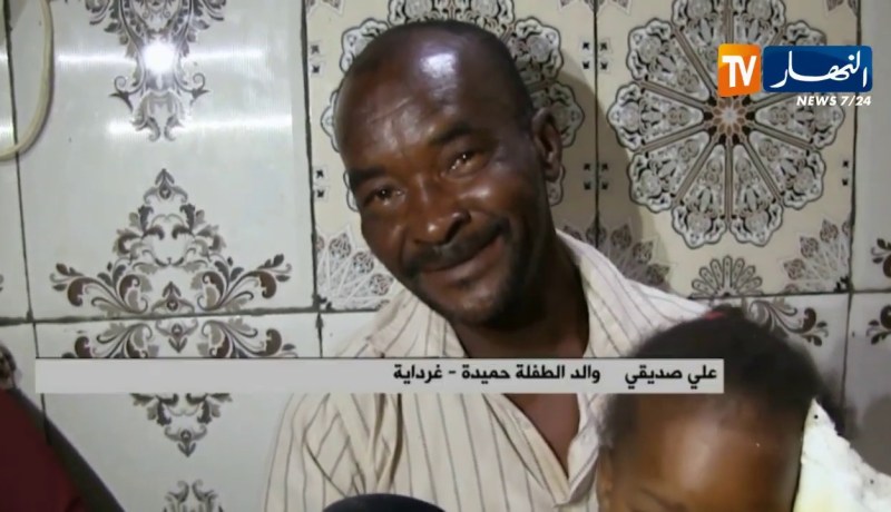 غرداية: مرض غريب يصيب الطفلة “حميدة” وعائلتها تناشد مرض غريب
