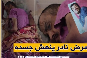 دلال خير: نسيم شاب في الثلاثينات نهش مرض غريب لحمه وجلده ووالده يتعذب معه