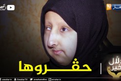 دلال خير: مراهقة ولدت بتشوهات خلقية وسط مجتمع لا يرحم جعلها حبيسة المنزل وأثر عليها نفسيا