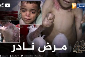 دلال خير: طفل يتألم كل يوم كأنه إحترق والأطباء لم يشخصوا مرضه بعد.. عائلته تناشد المحسنين لمساعدته