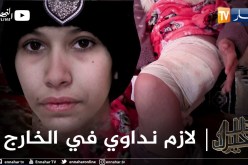 دلال خير: فتاة في عمر الزهور مصابة بورم خبيث أملها الوحيد العلاج في الخارج أو بتر رجلها هنا بالجزائر