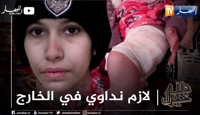 دلال خير: فتاة في عمر الزهور مصابة بورم خبيث أملها الوحيد العلاج في الخارج أو بتر رجلها هنا بالجزائر