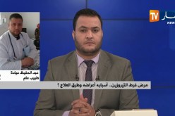 طبيب عام : ” مرض فرط التيروزين نادر جدا ويمكن إكتشافه مبكرا !! “