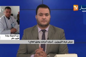 طبيب عام : ” مرض فرط التيروزين نادر جدا ويمكن إكتشافه مبكرا !! “