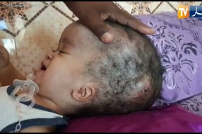 المغير: البراءة عبد الله سنة من المعاناة يناشد السلطات بالتكفل الصحي