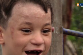 مجتمع: إسلام.. ملاك مشوه ينتظر إلتفاتة المحسنين